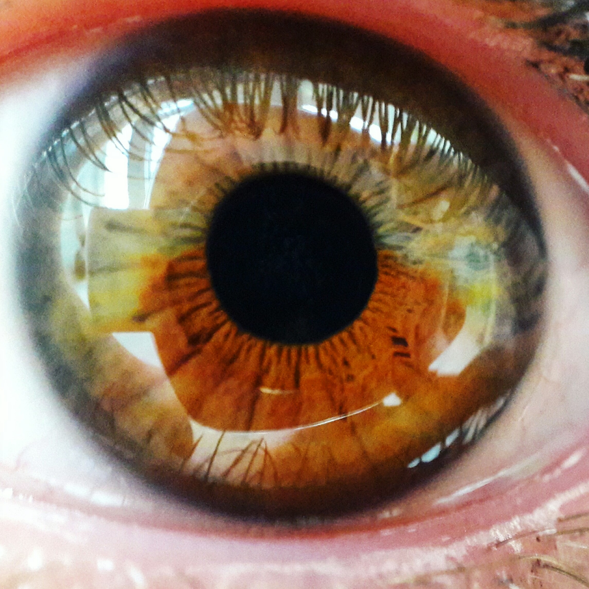Пестрые глаза. Гетерохромия радужной оболочки. Центральная гетерохромия глаз. Центральная гетерохромия радужной оболочки глаза. Цвет глаз гетерохромия Центральная.